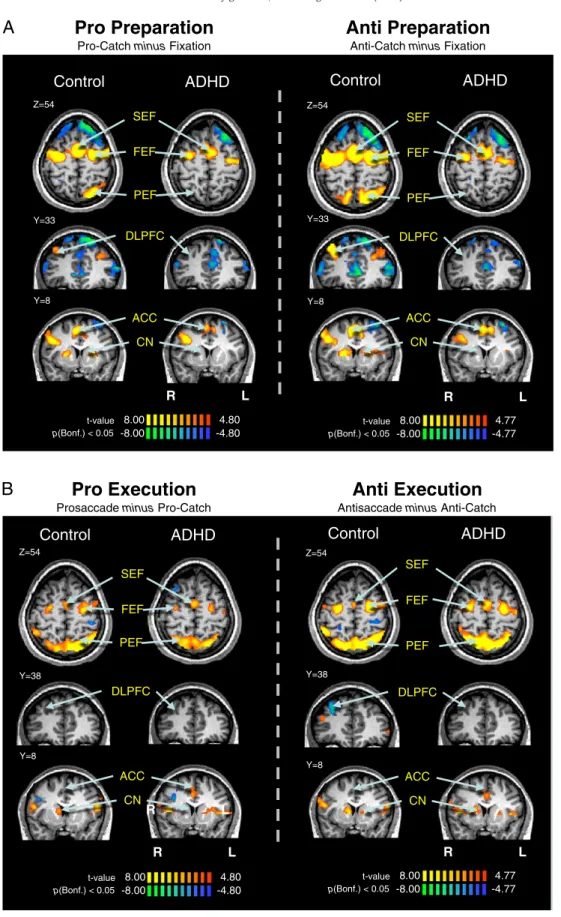 Fig. 4. Saccade preparation (A) and saccade execution (B) contrast maps. (A) Contrast map of pro-catch trials or anti-catch trials subtracted from ﬁxation trials, cluster size corrected at pb.05 (9 contiguous voxels)
