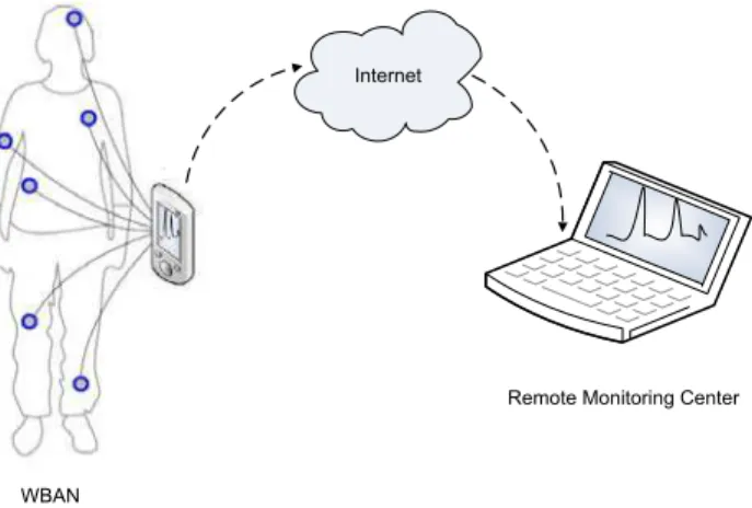 Fig. 1. An example of Wireless Body Area Network