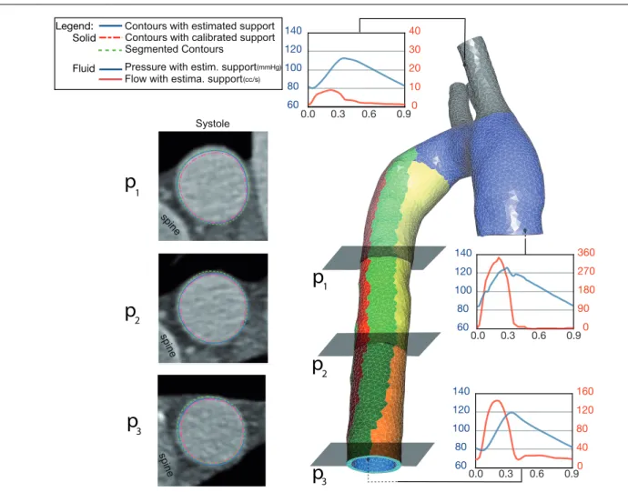 Fig. 14 Left: comparison of segmented (dashed green) vs. simulated (blue with estimated values and pink with manually calibrated values) lumen contours at peak systole – Right: computed fluid pressures and velocities at inlet and outlets