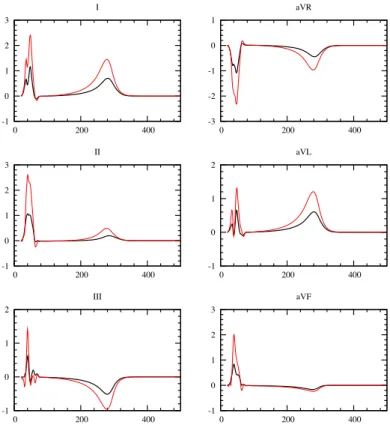 Figure 8: Simulated ECG signals (standard and augmented leads) obtained using heart-torso full coupling (black) and uncoupling (red).