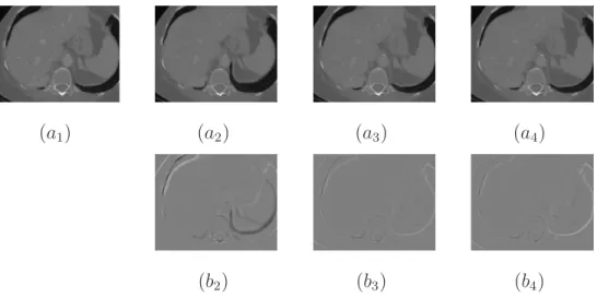 Figure 5. Images extracted from a series of CT images of the upper abdomen before estimation