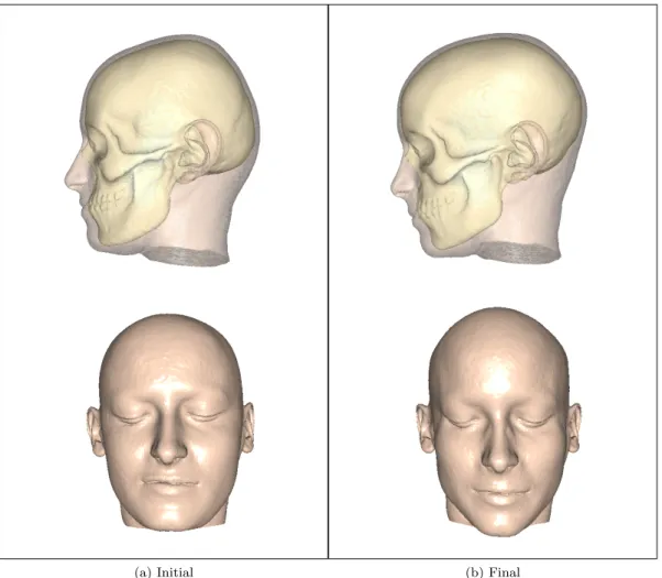 Figure 14 – Elastic deformation of the mask under the effect of skull changes.