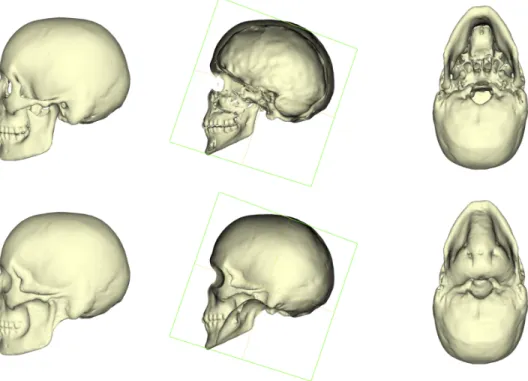 Figure 6 – Top: 3d model of the skull. Bottom: wrapped skull.