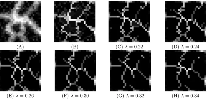 Figure 2 – (A) : Image 25*25 bruit´ee avec σ = 10% et √ ˆ