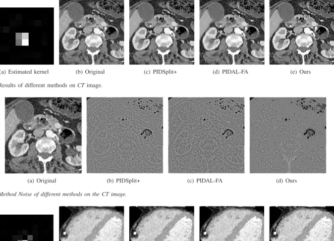 Fig. 12. Method Noise of different methods on the CT image.