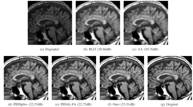 Fig. 15. Resulting PSNR values of our method on Brain image corrupted by the Gaussian blur and Poisson noise with peak intensity 600 when increasing the values of λ for different γ.