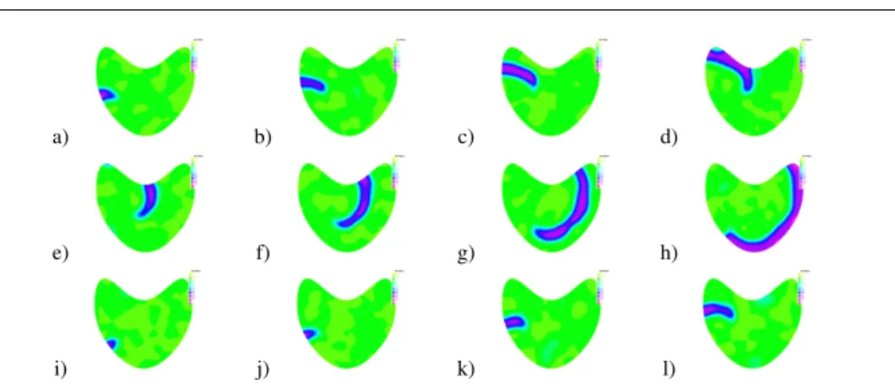 Fig. 8 Simulations of system (23) with ξ = 2, σ = 0.15, ε = 0.05, a = 0.75, b = 0.01 and ν = 1