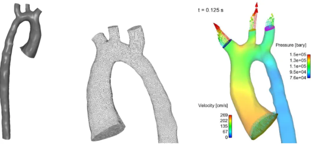 Figure 3: Patient-specific aorta. Left: geometry. Center: surface mesh. Right: simulation results for the aorta (vector velocity field and pressure distribution).