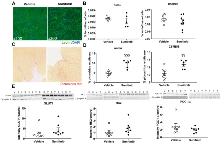 Figure 3. Sunitinib-induced increased FDG uptake in fasted mice is associated with increased fibrosis: (A) Representative sections of myocardium stained for  blood vessels (lsolectine B4 Griffonia Simplicifolia-FITC, green) and nuclei (DAPI, blue)