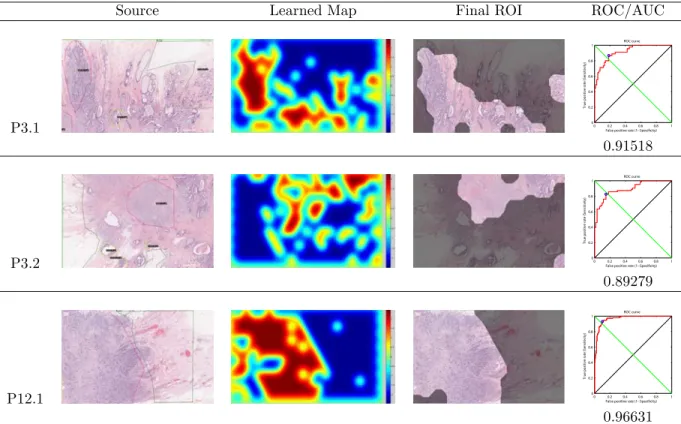 Table 1: Examples of ROIs detected by our system and their corresponding quantitative assessment