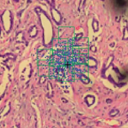 Figure 3: An example of breast biopsy (histopathology) image from our virtual microscopic platform