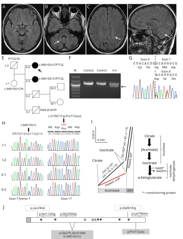 Figure Cerebral MRI and molecular and enzymatic analysis