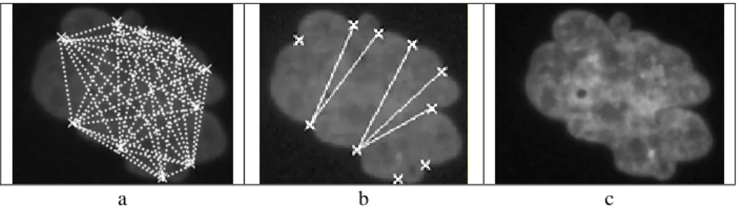 Fig. 8. In case of very big and lobulated nucleus potential segments of separation (a)   can fit the overlapping template (b) but don’t satisfy the gray-level criterion (c) 