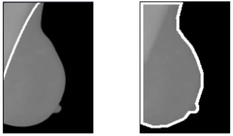 Figure 2 – Exemples de contours actifs basés contours (contour  ouvert à gauche ou fermé à droite) 