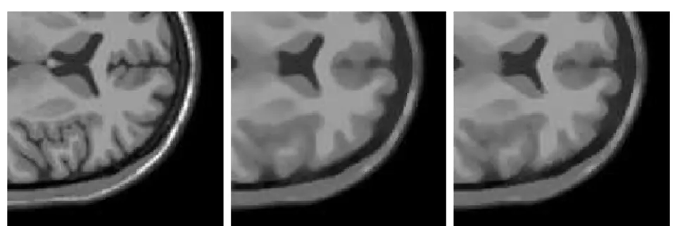 Figure 3.1. Median and linearized median. On the left a piece of brain image slice.