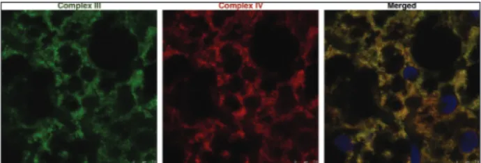 Fig. 2. Immunogold localization of complexes III (10 nm gold)  and IV (20 nm gold) in BAT mitochondria-enriched fractions