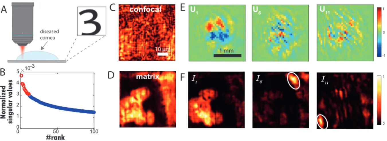 Figure 5: Imaging through a cornea with compromised transparency. (A) Schematic of the experiment