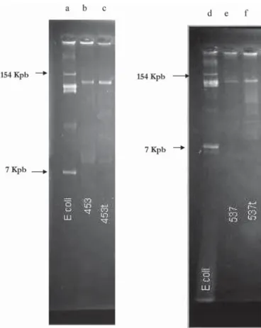 Fig. 1. Plasmid analysis of Acinetobacter baumannii isolates. a; d: Plasmids of reference size (Escherichia coli NCTC 50192)