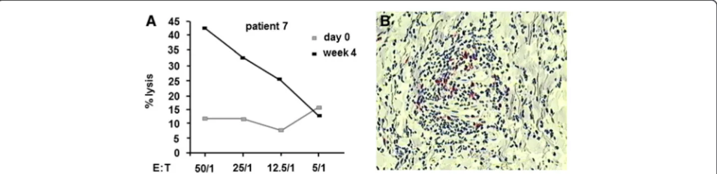 Figure 4 Cellular anti-tumor response. (A) Cytotoxic T lymphocyte (CTL) response in patient 7