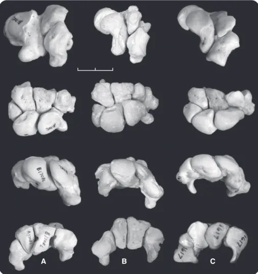 Fig. 3. Articulated wrists (left sides) of hominoids (no pisiform) in maximum dorsiflexion