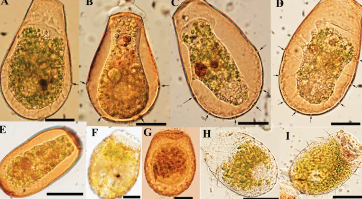 Figure 1. Light microscopy photographs of (A-D) Hyalosphenia papilio, arrows indicate the number of pores present at the shell edge, (E) Archerella ﬂavum, (F, G) Heleopera sphagni and (H, I) Placocista spinosa