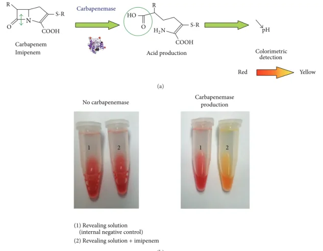 Figure 5: Principle (a) and interpretation (b) of the Carba NP test recently developed for the rapid identification of carbapenemase producers among Enterobacteriaceae and Pseudomonas spp.