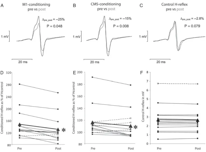Figure 4. Results from Experiment II. The effects of low-frequency rTMS on the early facilitation obtained with M1-conditioning ( A and D ) and CMS-conditioning ( B and E ).