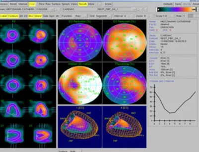 Figure 9. Analyse semi-quantitative grâce au bullseye (tiré d’Almange, André-Fouët, et al