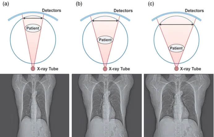Figure 3. Minification (a) or magnification (c) of the patient's lateral dimensions occurs when the patient is not well