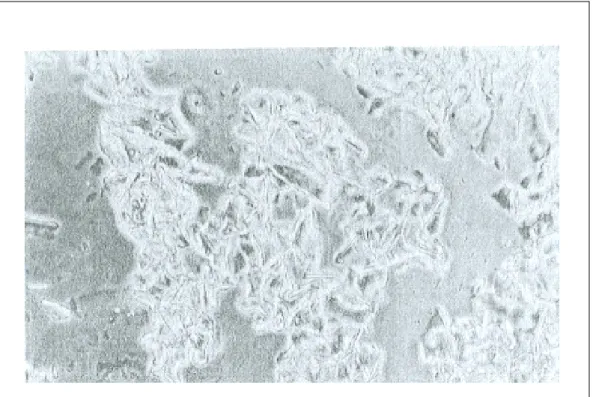 Figure 3: Fine-grain structure of aluminum gel stored at the optimal temperature (154)