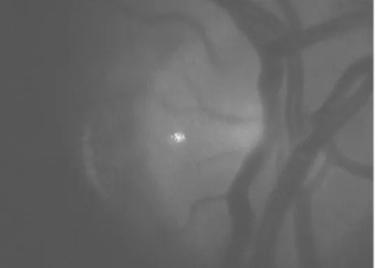 Fig. 3 Example of an image of the fundus is taken by the instrument. The probing beam can be seen in the middle of the image.