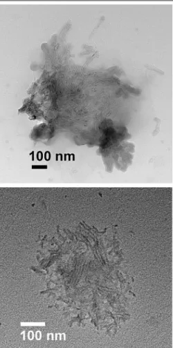 Fig. 4. Top: TEM image of OPBA-PEG block copolymer 1c deposited from DMSO solution (0.5 mg mL –1 ) onto a carbon-coated nickel TEM grid