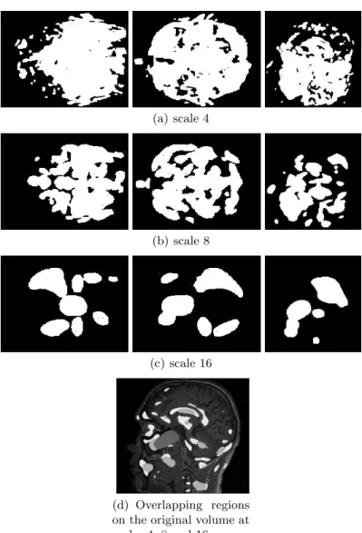 Fig. 4. 2D binary projections at various scales; original volume with regions detected.