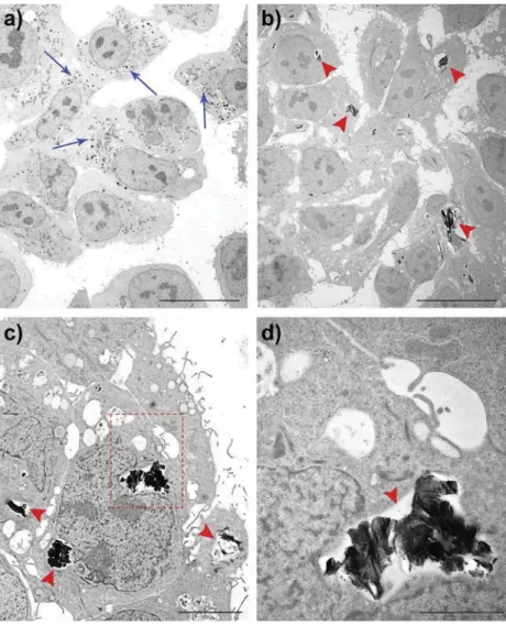 Fig. 6 – Transmission electron micrographs of A549 cells exposed for 4 days to the culture medium alone ((a); blue arrows point to some of the lamellar body structures that are abundant in the cytoplasm) or 12.5 lg/cm 2 graphene oxide (b–d).