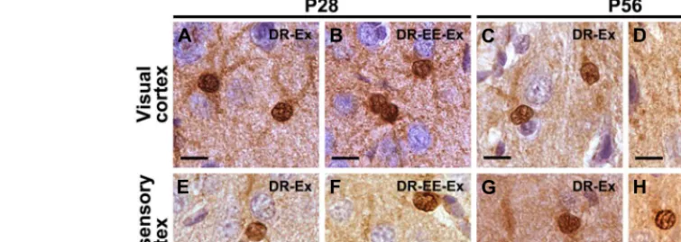 FIGURE 3 | S-100β staining shows that there are no morphological differences between astrocytes at any of the different ages and studied groups neither in the visual cortex nor in the somatosensory cortex.