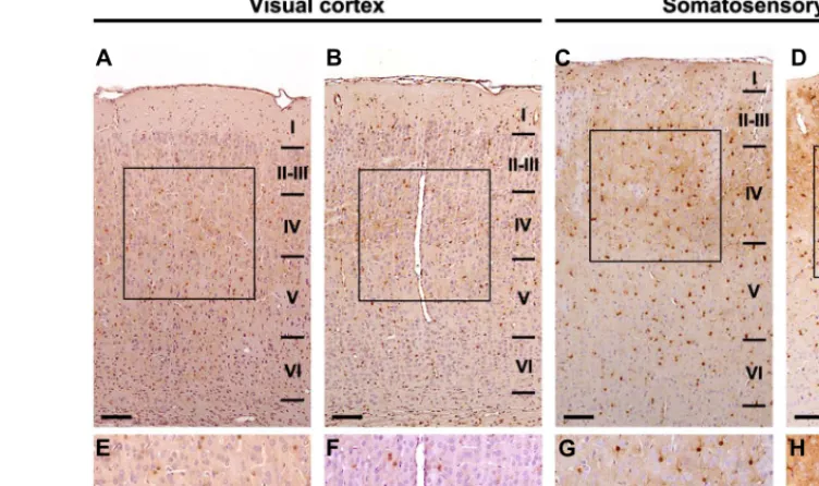 FIGURE 4 | Stereological analysis is required to discern astrocyte density differences between experimental conditions