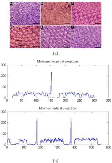 Figure 3: Example of (a) an image and (b) its minimum projections.