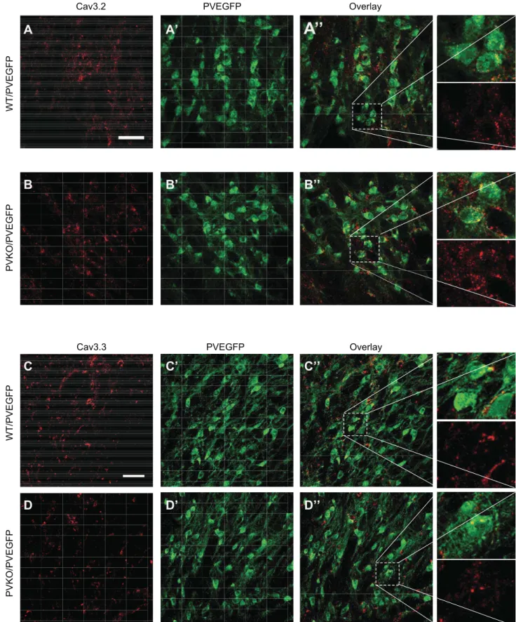 Fig. 6. Differential expression of Ca v 3.2 in PVKO RTN. A and B: ﬂuorescence immunohistochemistry using Ca v 3.2- and EGFP-speciﬁc antibodies shows that Ca v 3.2 is enriched in the soma of PV-EGFP-positive neurons in PVKO RTN