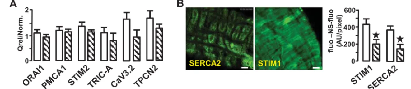 Figure S1: Ca 2+ channels and pumps implicated in Ca 2+ signalling in VSMC. GPCR (G-protein  coupled receptors) located in plasma membrane (PM) activate transduction pathways to produce InsP3  (via activation of phospholipase C, PLC) or cADP (via CD38 acti