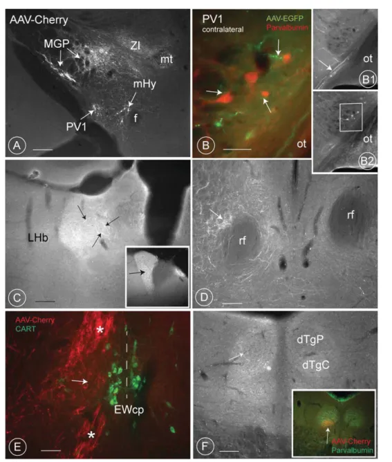 Figure 6. AAV- colabeling of other structures in the mouse diencephalon. A: In addition to the PV1 nucleus, neurons in the medial globus pallidus (MGP, also called the entopeduncular nucleus), the subthalamic nucleus, the reticular nucleus of the thalamus 