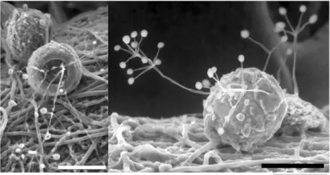 Figure 1.4: Phryganella acropodia colonized by fungal hyphae. Laboratory culture by  Martin Vohník, Wilkinson (2008)