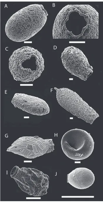 Figure 1. Scanning electron micrographs of tests from species treated in this study. A) Netzelia  ovi-formis, B) Aperture view of N