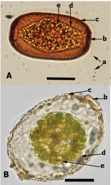 Figure 1. Light microscopy photograph for Archerella flavum (A) and Amphitrema wrightianum (B): the arrows indicate a) filose pseudopodia; b) pseudostome (shell aperture); c) shell (test);