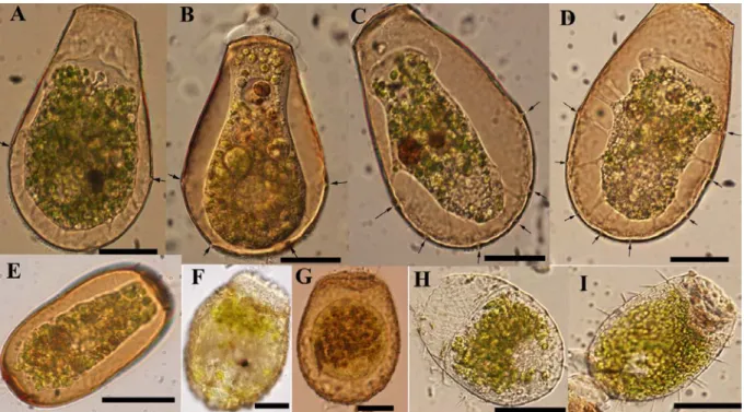 Figure  1.  Light microscopy photographs  of  (A-D)  Hyalosphenia papilio, arrows  indicate the number of pores present at the shell edge, (E) Archerella flavum, (F, G)  Heleopera sphagni and (H, I) Placocista spinosa