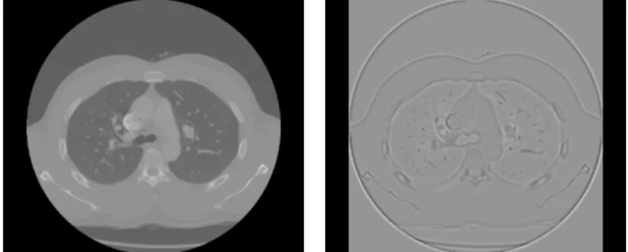 Figure 2 shows an example of the result of a CT scan filtered at various wavelet scales.