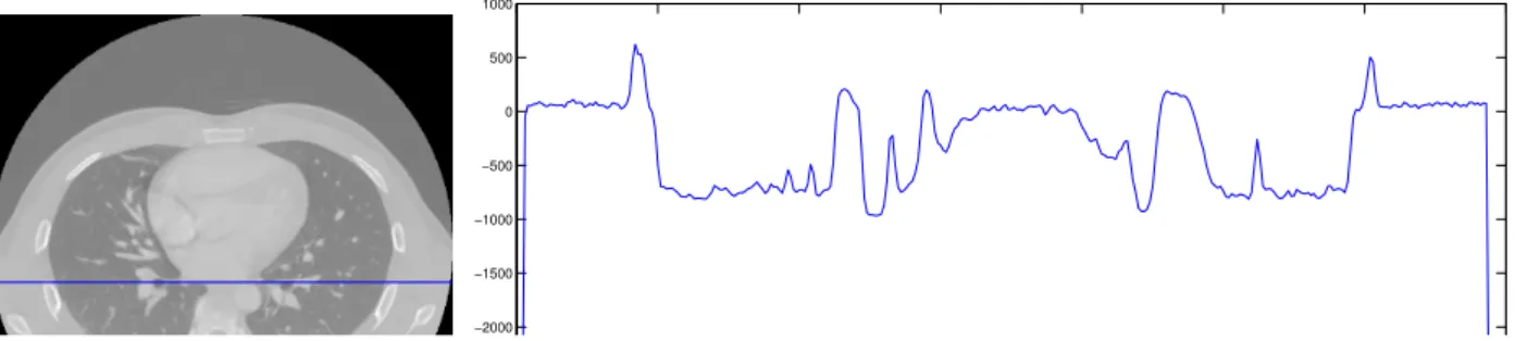 Figure 3. Examples of wavelet images and the representation of the values. Regional maxima and minima directly correspond to salient regions in the wavelet images 3(b) and 3(c) in contrast to 3(c), where saliency corresponds to large differences in gray le
