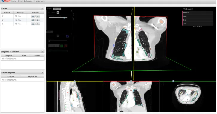 Figure 6. Screenshot of the region–based volumetric retrieval interface
