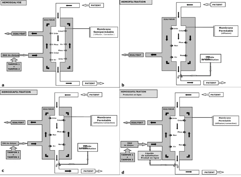 Figure 2: Techniques d’épuration sanguine extra-rénale