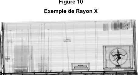 Figure 10  Exemple de Rayon X 