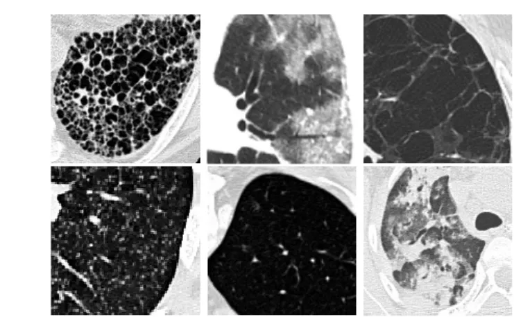 Fig. 2. Examples for texture in lung tissue showing (from top left to bottom right):